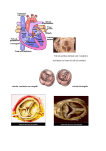 Aorta dilattata e valvola bicuspide 2