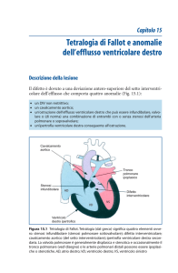 Tetralogia di Fallot e anomalie dell`efflusso ventricolare destro
