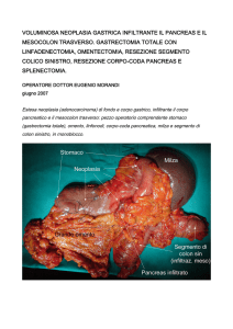 voluminosa neoplasia gastrica infiltrante il pancreas e il mesocolon