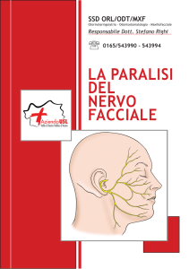 la paralisi del nervo facciale