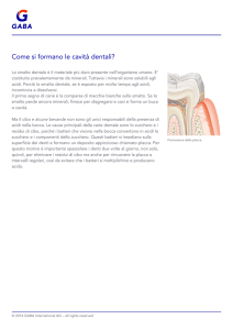 - Come si formano le cavità dentali?