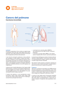 Cancro del polmone - Carcinoma bronchiale