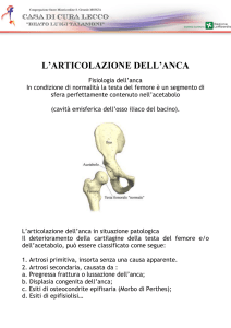 Artroprotesi dell`anca