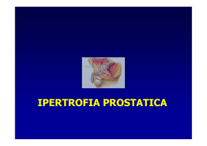 L`ipertrofia della prostata