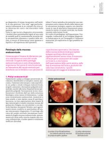 1. Polipi endocervicali Patologia della mucosa endocervicale