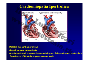 Cardiomiopatia Ipertrofica