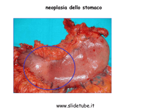 neoplasia dello stomaco www.slidetube.it