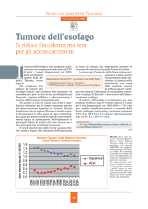 Tumore dell`esofago - News sui tumori in Toscana