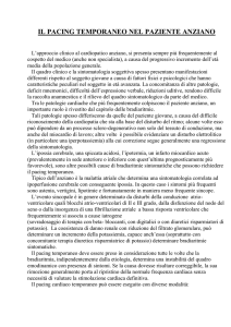 il pacing temporaneo - associazione nazionale sanita` militare italiana