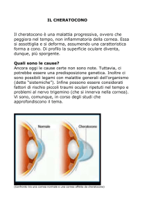 il-cheratocono-1 - Blog Chirurgia refrattiva Roma