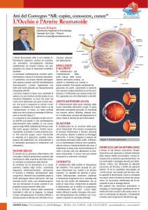 L`Occhio e l`Artrite Reumatoide