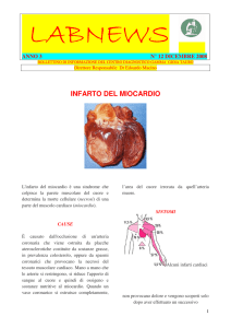 infarto del miocardio - Centro Diagnostico Gamma
