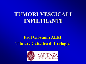tumori vescicali - Prof. Giovanni Alei