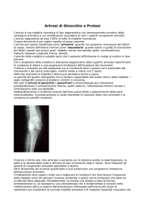 Artrosi di Ginocchio e Protesi