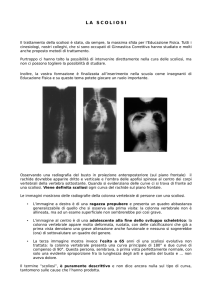 la scoliosi - Cinesiologi.it