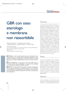 GBR con osso eterologo e membrana non riassorbibile