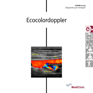 Ecocolordoppler
