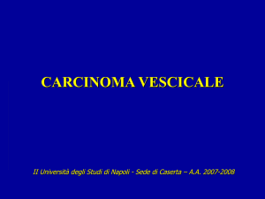 carcinoma della vescica - CircolodegliUniversitari