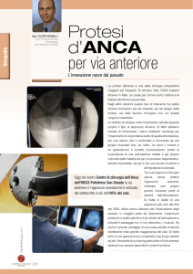 Protesi d`ANCA per via anteriore