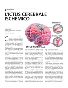 L`Ictus Cerebrale Ischemico
