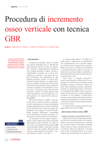 Procedura di incremento osseo verticale con tecnica GBR