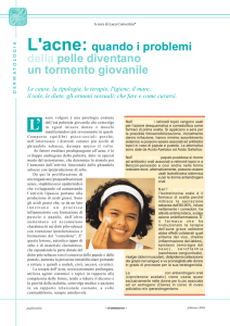 L`acne: quando i problemi della pelle diventano un tormento giovanile