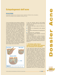 Eziopatogenesi dell`acne