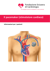Il pacemaker (stimolatore cardiaco)
