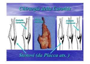 Chirurgia della Carotide Stenosi (da Placca ats. )