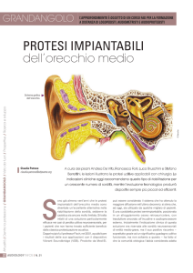 protesi impiantabili