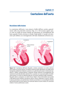 Coartazione dell`aorta
