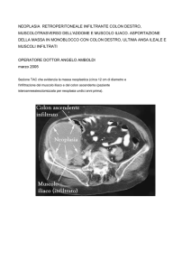 Neoplasia retroperitoneale infiltrante colon destro, muscolo