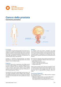 Scheda informativa: Cancro della prostata