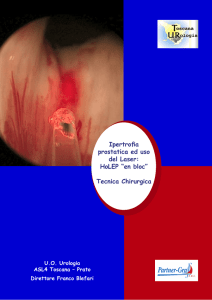 Ipertrofia prostatica ed uso del Laser: HoLEP