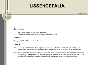 lissencefalia