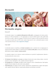 Dermatiti Dermatite atopica