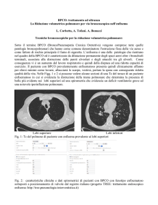 La Riduzione volumetrica polmonare per via broncoscopica nell