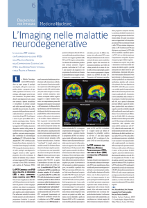 L`Imaging nelle malattie neurodegenerative