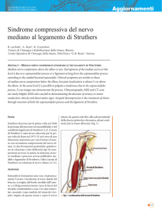 Sindrome compressiva del nervo mediano al legamento di Struthers