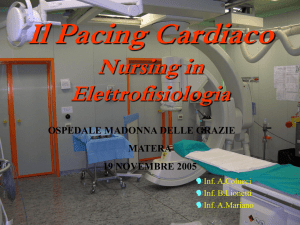 Il Pacing Cardiaco