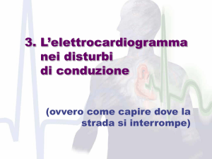 L`elettrocardiogramma nei disturbi di conduzione