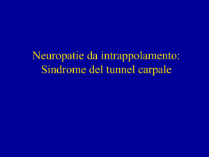 Neuropatie da intrappolamento: Sindrome del