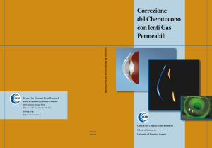 Correzione del Cheratocono con lenti Gas Permeabili