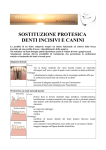 sostituzione protesica denti incisivi e canini