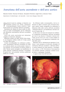 Aneurisma dell`aorta ascendente e dell`arco aortico