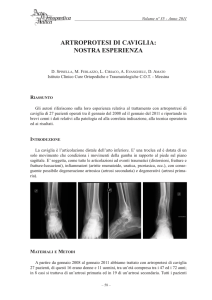 artroprotesi di caviglia: nostra esperienza