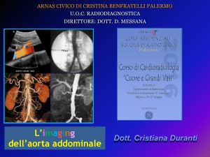 Aorta addominale - Lord of the Rays