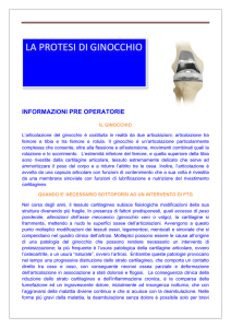 informazioni preoperatorie per la chirurgia protesica di ginocchio