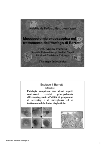 Mucosectomia endoscopica nel trattamento dell`esofago