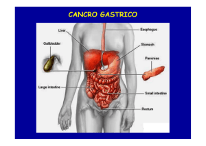 cancro gastrico - Fisiokinesiterapia